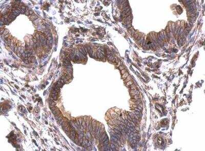Immunohistochemistry-Paraffin: Periplakin Antibody [NBP2-19775]
