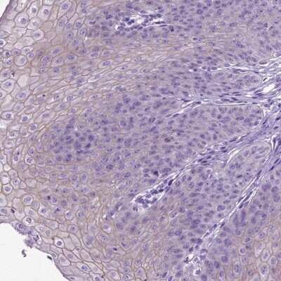 Immunohistochemistry-Paraffin: Periplakin Antibody [NBP2-49306]