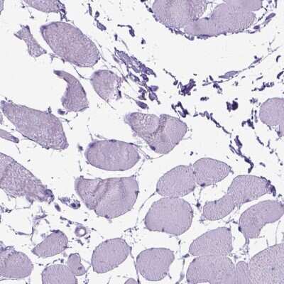 Immunohistochemistry-Paraffin: Periplakin Antibody [NBP2-49306]