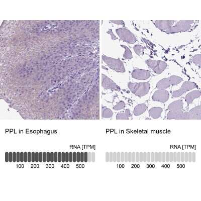 Immunohistochemistry-Paraffin: Periplakin Antibody [NBP2-49306]