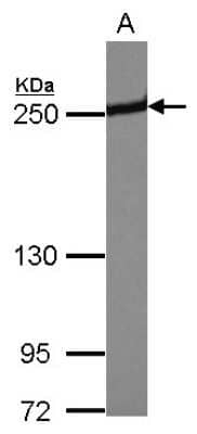 Western Blot: Periplakin Antibody [NBP2-19775]