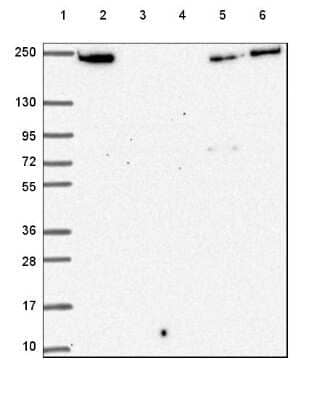 Western Blot: Periplakin Antibody [NBP2-49306]