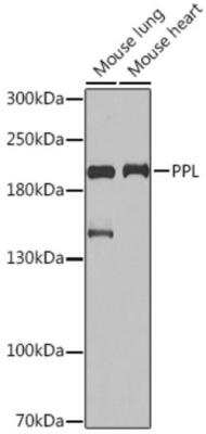 Western Blot: Periplakin AntibodyBSA Free [NBP2-94787]