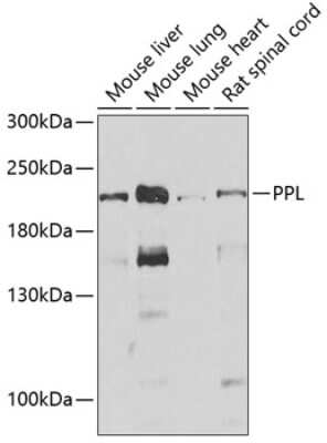 Western Blot: Periplakin AntibodyBSA Free [NBP2-95228]