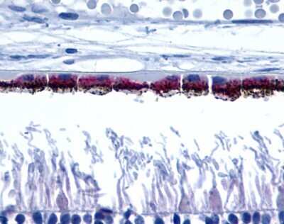 Immunohistochemistry-Paraffin: Peropsin Antibody - BSA Free [NLS1150]