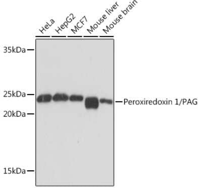 Western Blot: Peroxiredoxin 1 Antibody (3F8X3) [NBP3-16519]