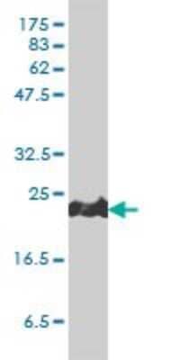 Western Blot: Peroxiredoxin 1 Antibody (4B11-D10) [H00005052-M01]