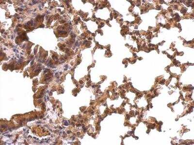 Immunohistochemistry-Paraffin: Peroxiredoxin 1 Antibody [NBP1-30973]
