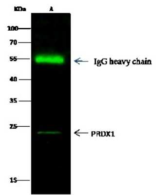 Immunoprecipitation: Peroxiredoxin 1 Antibody [NBP2-99736]