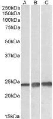 Western Blot: Peroxiredoxin 1 Antibody [NBP1-06064]