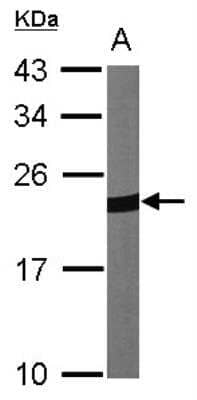 Western Blot: Peroxiredoxin 1 Antibody [NBP1-30973]