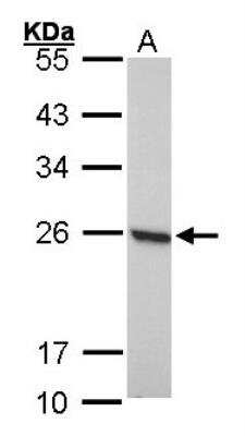 Western Blot: Peroxiredoxin 1 Antibody [NBP1-30973]