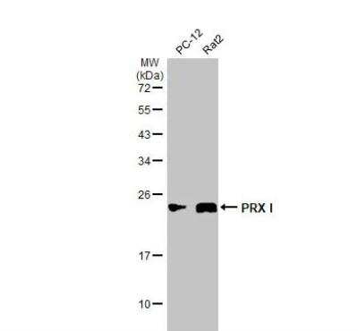 Western Blot: Peroxiredoxin 1 Antibody [NBP1-30973]