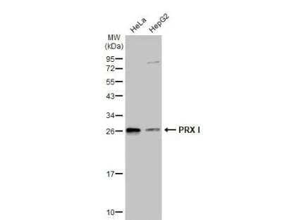 Western Blot: Peroxiredoxin 1 Antibody [NBP1-30973]