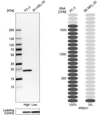 Western Blot: Peroxiredoxin 1 Antibody [NBP1-82558]