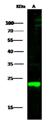 Western Blot: Peroxiredoxin 1 Antibody [NBP2-99736]