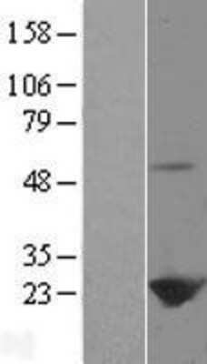 Western Blot: Peroxiredoxin 1 Overexpression Lysate [NBL1-14737]