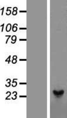 Western Blot: Peroxiredoxin 1 Overexpression Lysate [NBL1-14738]