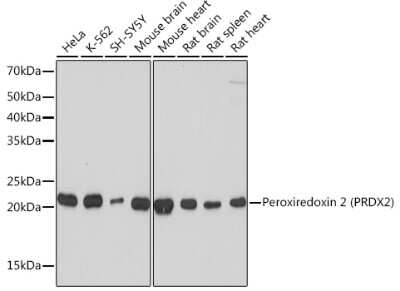 Western Blot: Peroxiredoxin 2 Antibody (1U9L9) [NBP3-16374]