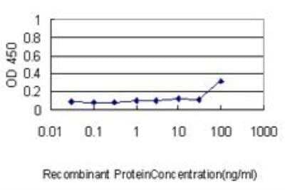 ELISA: Peroxiredoxin 2 Antibody (4E10-2D2) [H00007001-M01]