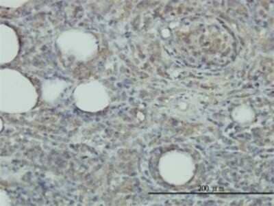 Immunohistochemistry-Paraffin: Peroxiredoxin 2 Antibody (4E10-2D2) [H00007001-M01]