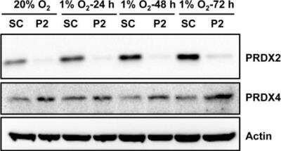 Knockdown Validated: Peroxiredoxin 2 Antibody (4E10-2D2) [H00007001-M01]