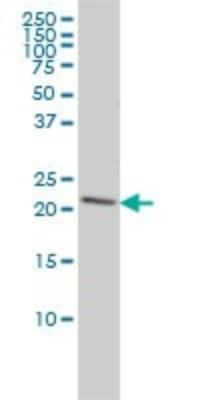 Western Blot: Peroxiredoxin 2 Antibody (4E10-2D2) [H00007001-M01]