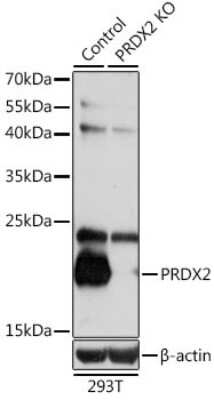 Knockout Validated: Peroxiredoxin 2 Antibody - BSA Free [NBP3-03275]