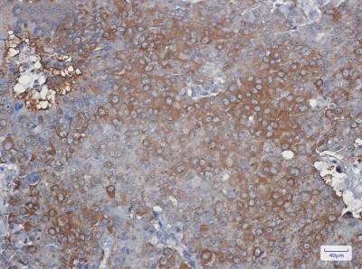 Immunohistochemistry-Paraffin: Peroxiredoxin 2 Antibody (S02-1G5) [NBP3-19735]