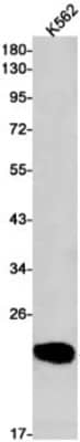 Western Blot: Peroxiredoxin 2 Antibody (S02-1G5) [NBP3-19735]