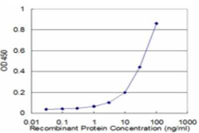 ELISA: Peroxiredoxin 2 Antibody (S2) [H00007001-M03]