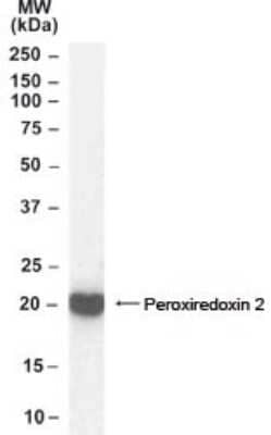 Western Blot: Peroxiredoxin 2 Antibody [NB100-40806]