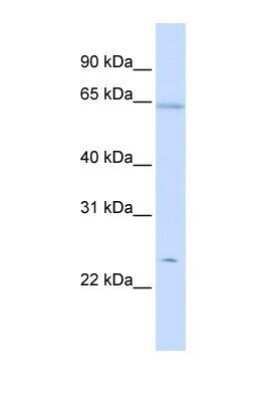 Western Blot: Peroxiredoxin 2 Antibody [NBP1-54337]