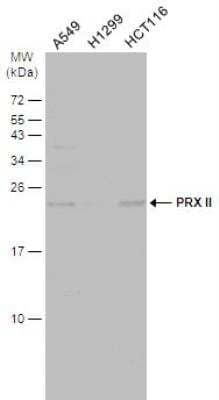 Western Blot: Peroxiredoxin 2 Antibody [NBP2-19776]