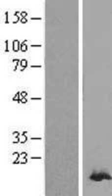 Western Blot: Peroxiredoxin 2 Overexpression Lysate [NBL1-14739]