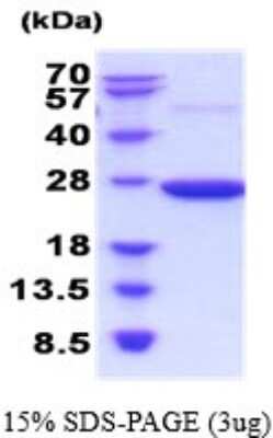 SDS-PAGE: Recombinant Rat Peroxiredoxin 2 His Protein [NBP2-52150]