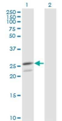 Western Blot: Peroxiredoxin 3 Antibody (1E3-B2) [H00010935-M01]