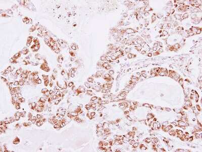 Immunohistochemistry-Paraffin: Peroxiredoxin 3 Antibody [NBP2-19777]