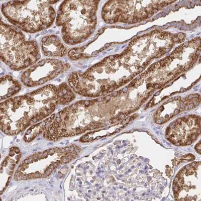 Immunohistochemistry-Paraffin: Peroxiredoxin 3 Antibody [NBP2-38486]