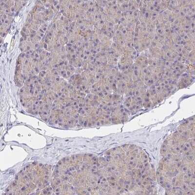 Immunohistochemistry-Paraffin: Peroxiredoxin 3 Antibody [NBP2-38486]