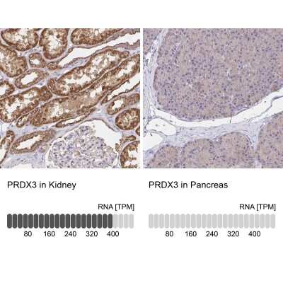 Immunohistochemistry-Paraffin: Peroxiredoxin 3 Antibody [NBP2-38486]