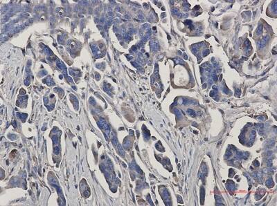 Immunohistochemistry-Paraffin: Peroxiredoxin 3 Antibody (S07-3I3) [NBP3-19906]