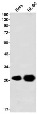 Western Blot: Peroxiredoxin 3 Antibody (S07-3I3) [NBP3-19906]