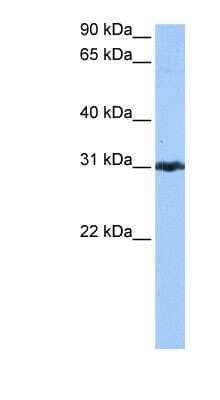 Western Blot: Peroxiredoxin 3 Antibody [NBP1-53060]