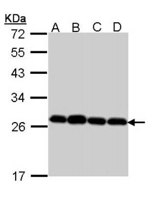 Western Blot: Peroxiredoxin 3 Antibody [NBP2-19777]