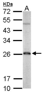 Western Blot: Peroxiredoxin 3 Antibody [NBP2-19777]