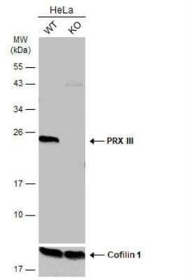 Western Blot: Peroxiredoxin 3 Antibody [NBP2-19777]