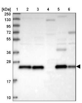 Western Blot: Peroxiredoxin 3 Antibody [NBP2-38486]