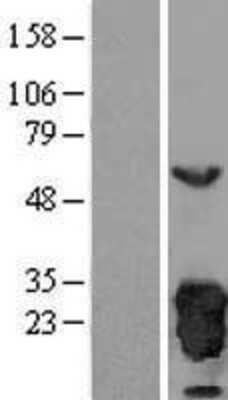 Western Blot: Peroxiredoxin 3 Overexpression Lysate [NBL1-14740]