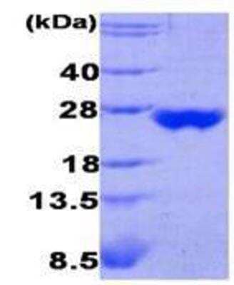 SDS-PAGE: Recombinant Human Peroxiredoxin 3 Protein [NBC1-27993]